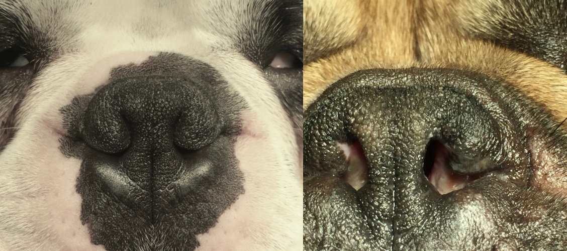 Nase vor und nach OP