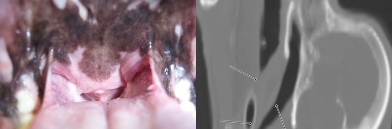 Gaumensegel endoskopisch CT