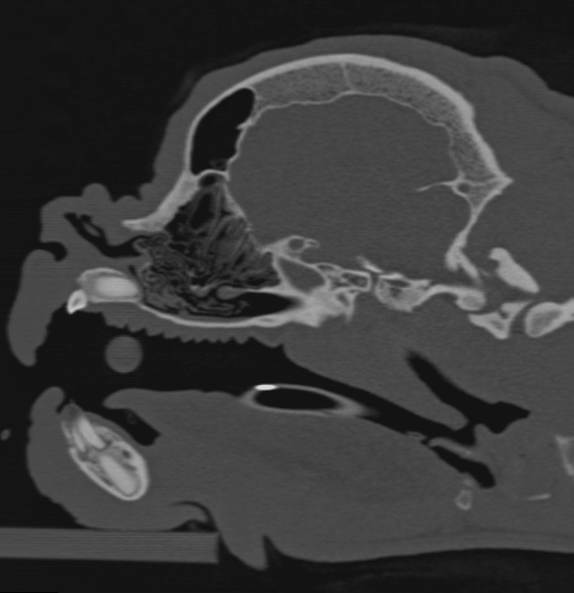 Thorax CT