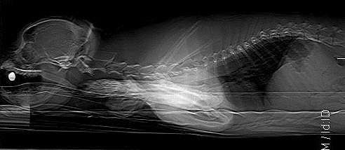 Thorax CT