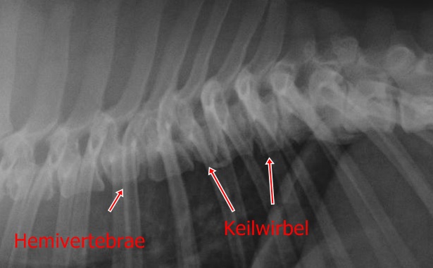 Hemivertebrae Keilwirbel